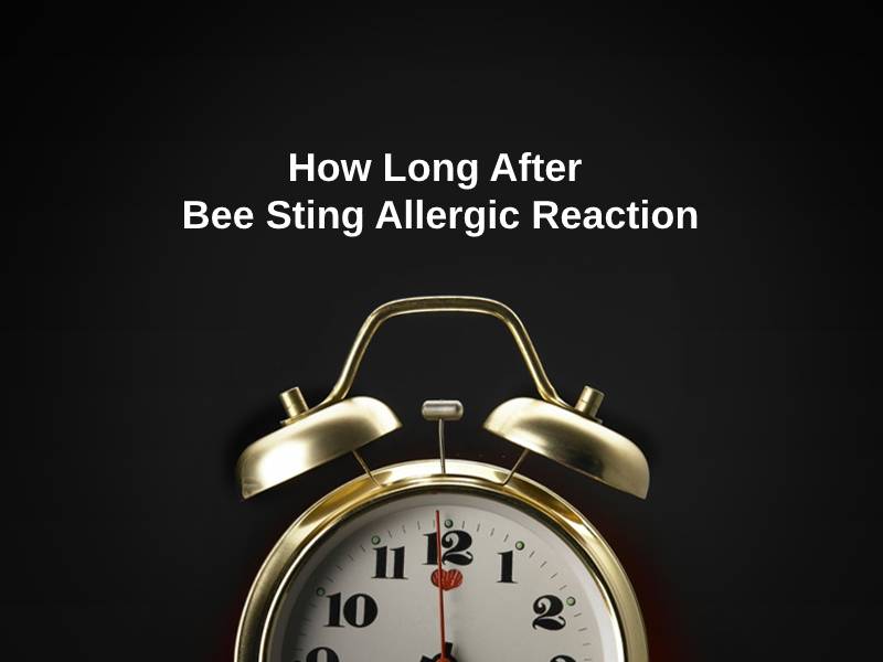 How Long After Bee Sting Allergic Reaction