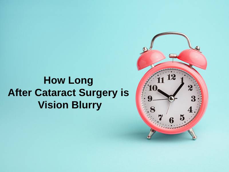 How Long After Cataract Surgery is Vision Blurry