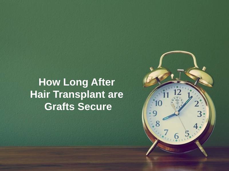 How Long After Hair Transplant are Grafts Secure