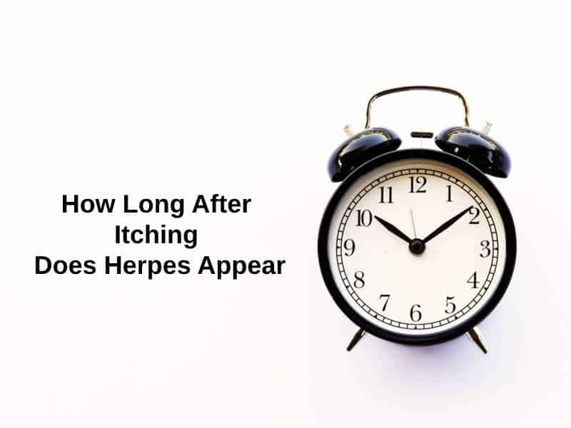 How Long After Itching Does Herpes Appear