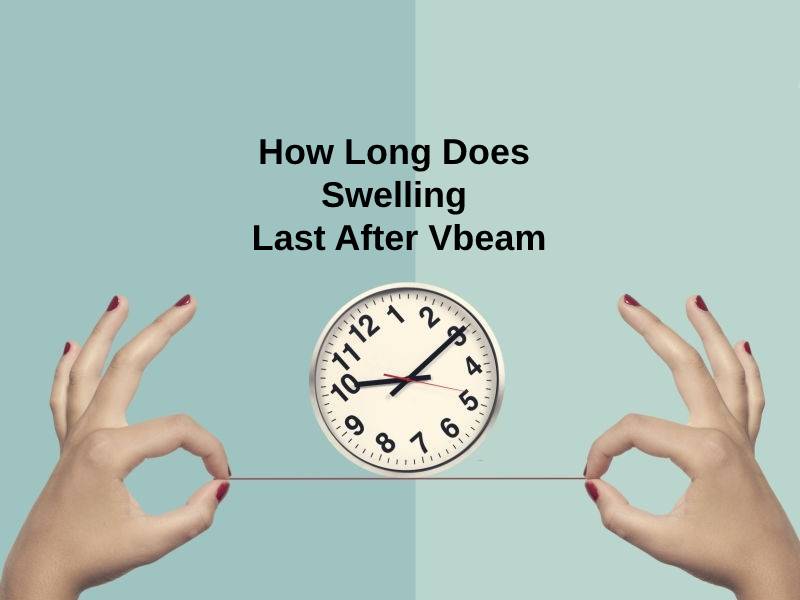 How Long Does Swelling Last After Vbeam
