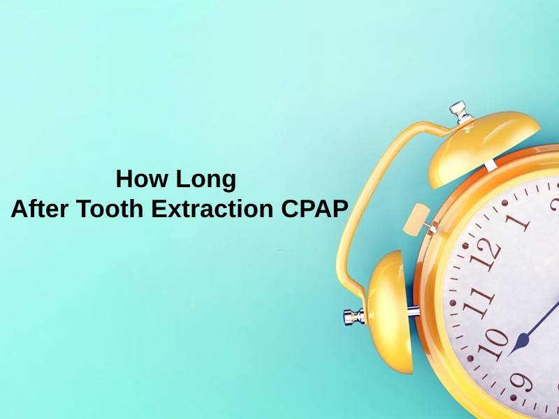 How Long After Tooth Extraction CPAP