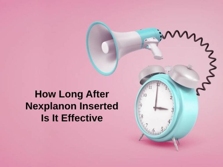 How Long After Nexplanon Inserted Is It Effective (And Why)?