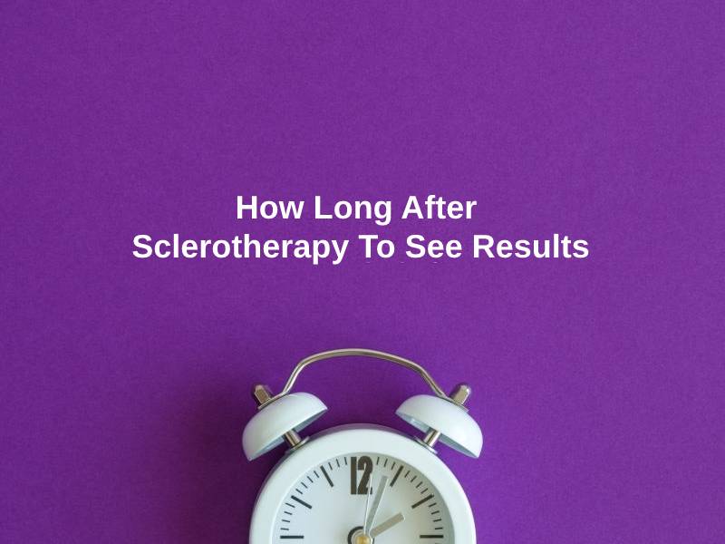 How Long After Sclerotherapy To See Results