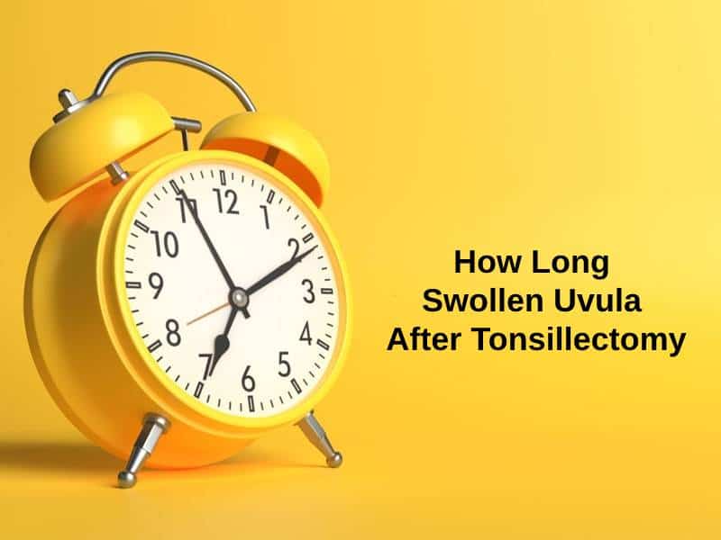 How Long Swollen Uvula After Tonsillectomy - Tonsillectomy is a surgical process in which the tonsils are removed completely from the back of the throat. This surgery is done to enable peaceful sleeping because tonsils cause loud snoring and to cure frequent infections. Some people are advised not to remove their tonsil as tonsil sometimes protects us from certain infections as they are a part of our immune system.  However, after removal, the tonsil area completely heals in about two to three weeks after surgery and a day or two after surgery, swelling is seen to develop in that area. As to why and how long it stays, we will discuss it in this article.