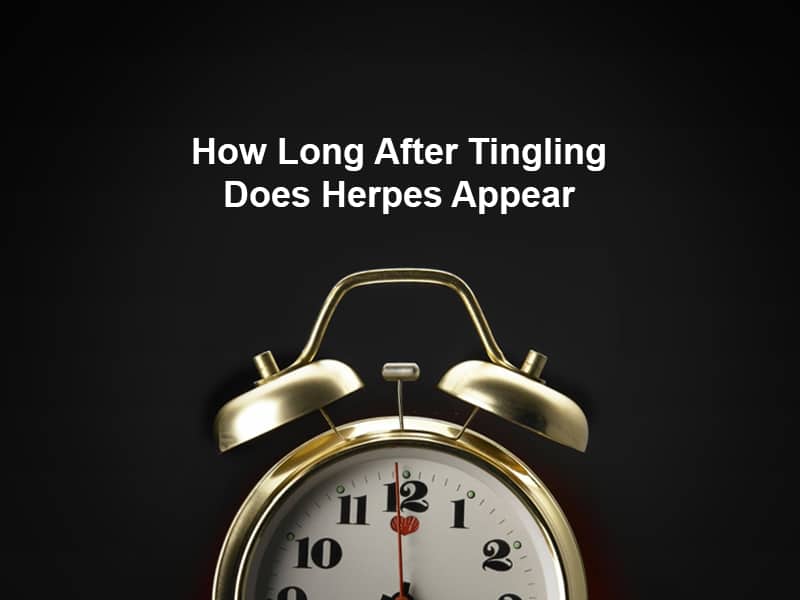 How Long After Tingling Does Herpes Appear