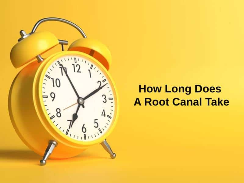 How Long Does A Root Canal Take