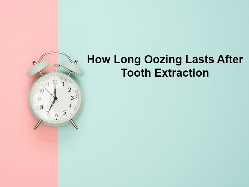 How Long Oozing Lasts After Tooth