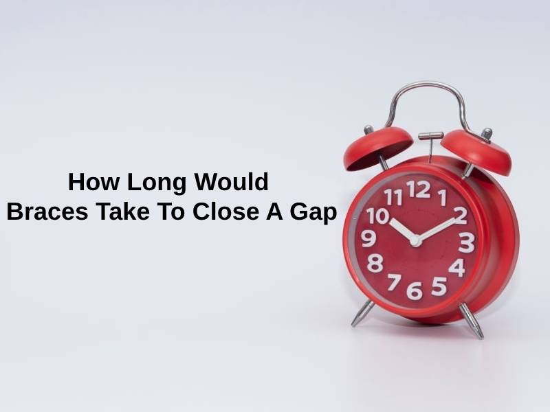 How Long Would Braces Take To Close A Gap