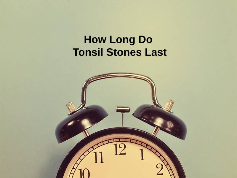 How Long Do Tonsil Stones Last