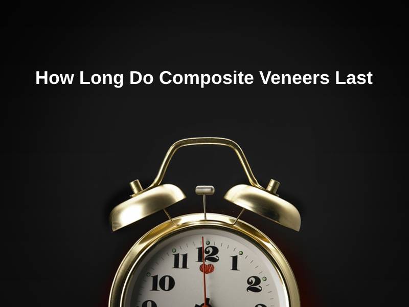 How Long Do Composite Veneers Last