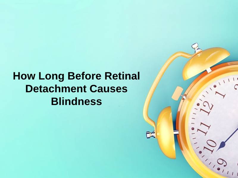 How Long Before Retinal Detachment Causes Blindness