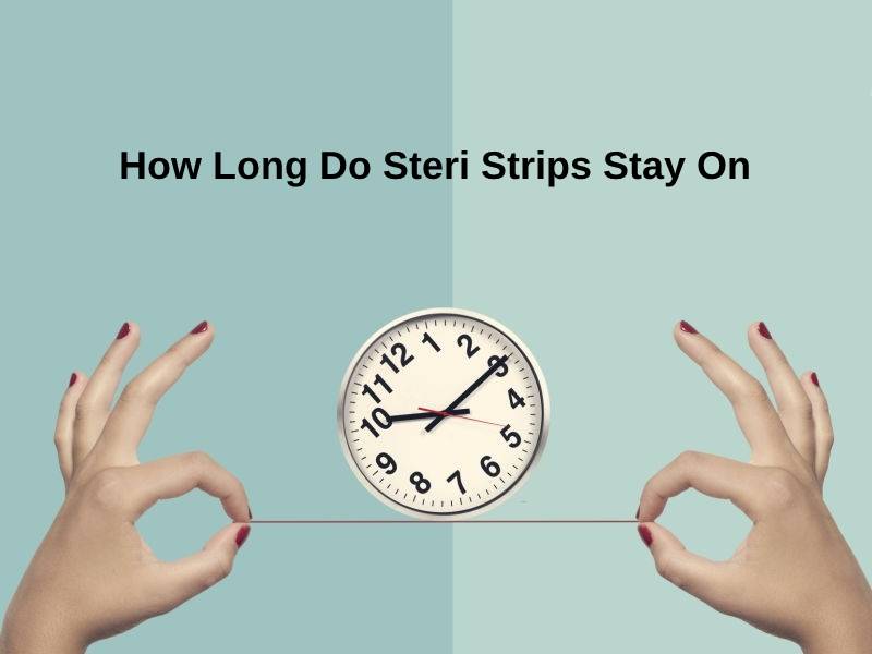How Long Do Steri Strips Stay On