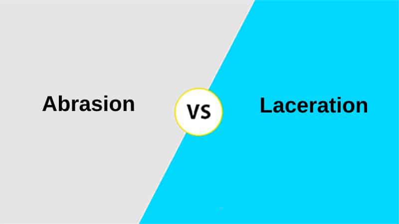 Difference-Between-Abrasion-and-Laceration