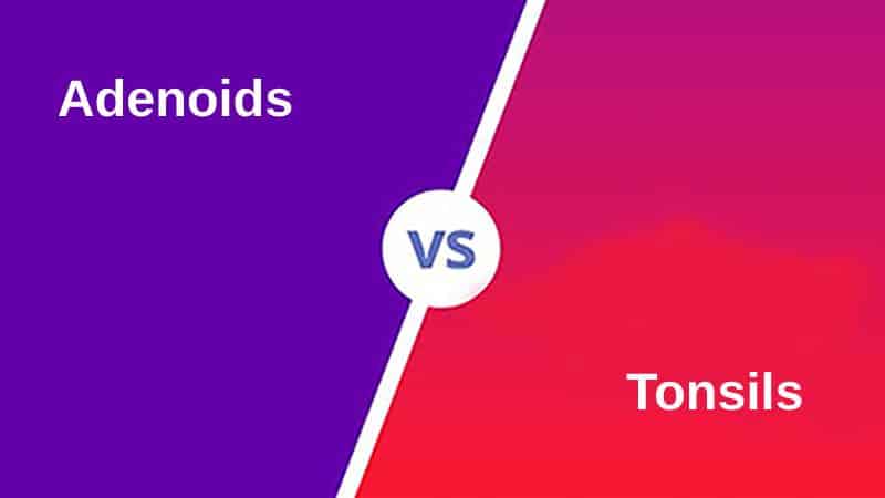 what-s-the-difference-between-adenoids-and-tonsils