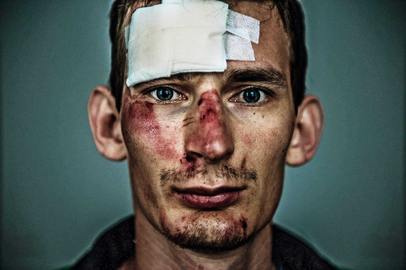 Head Injury