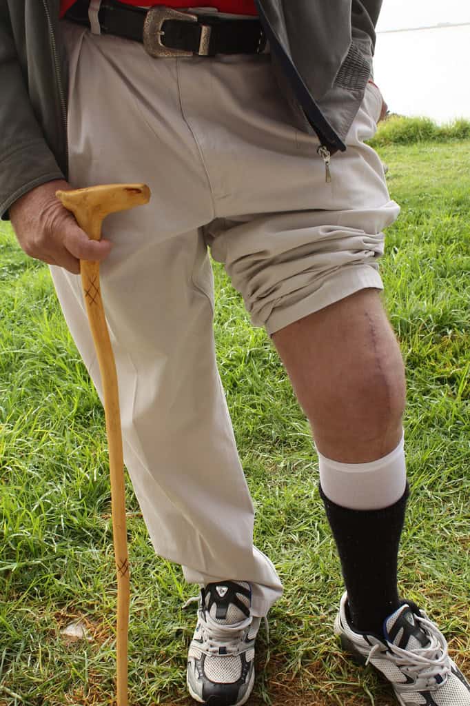 7-ways-to-help-improve-stiffness-and-pain-1-year-after-knee-replacement