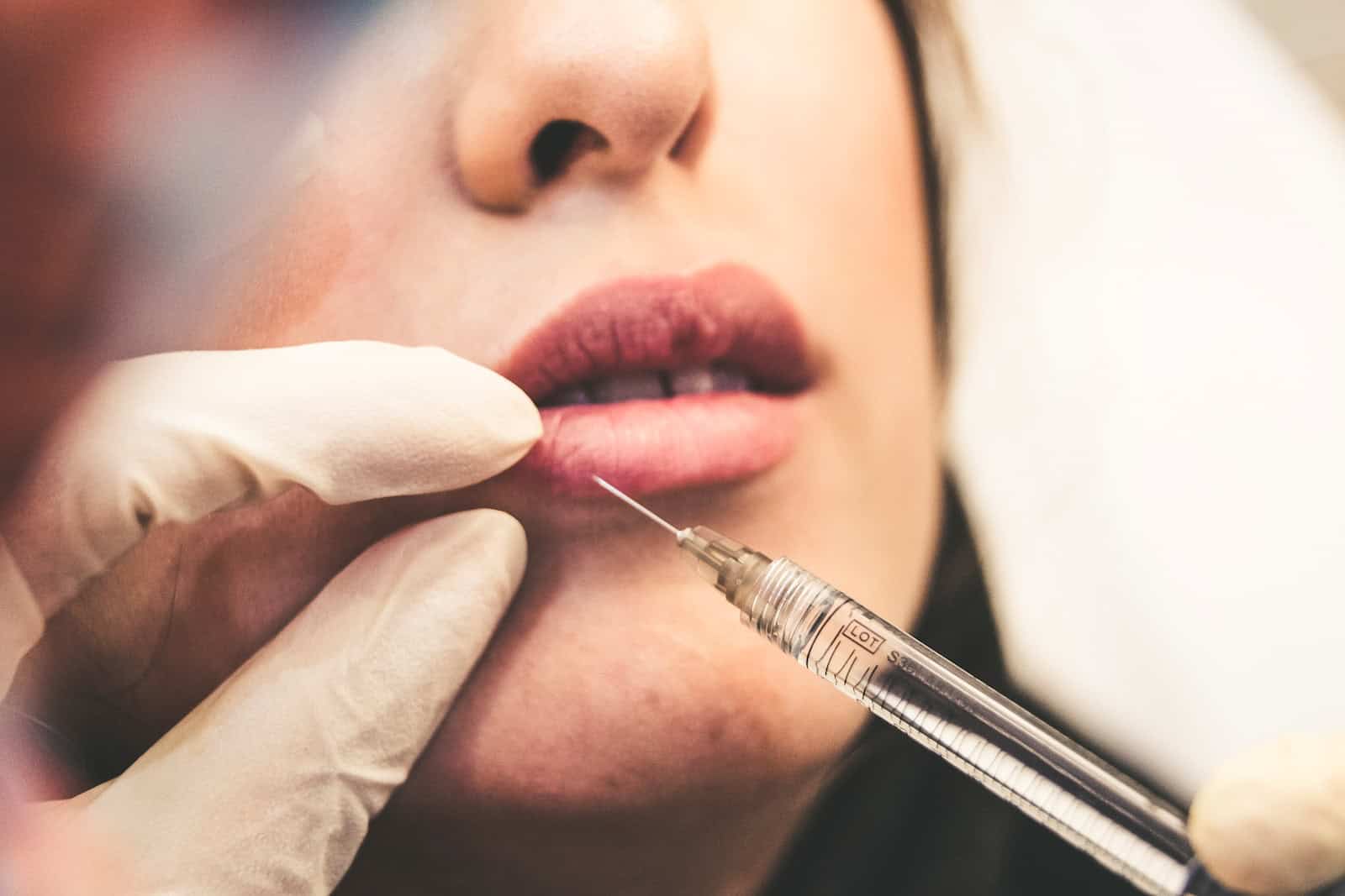 Lip Injection