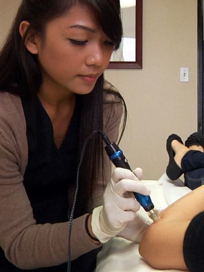 Microneedle