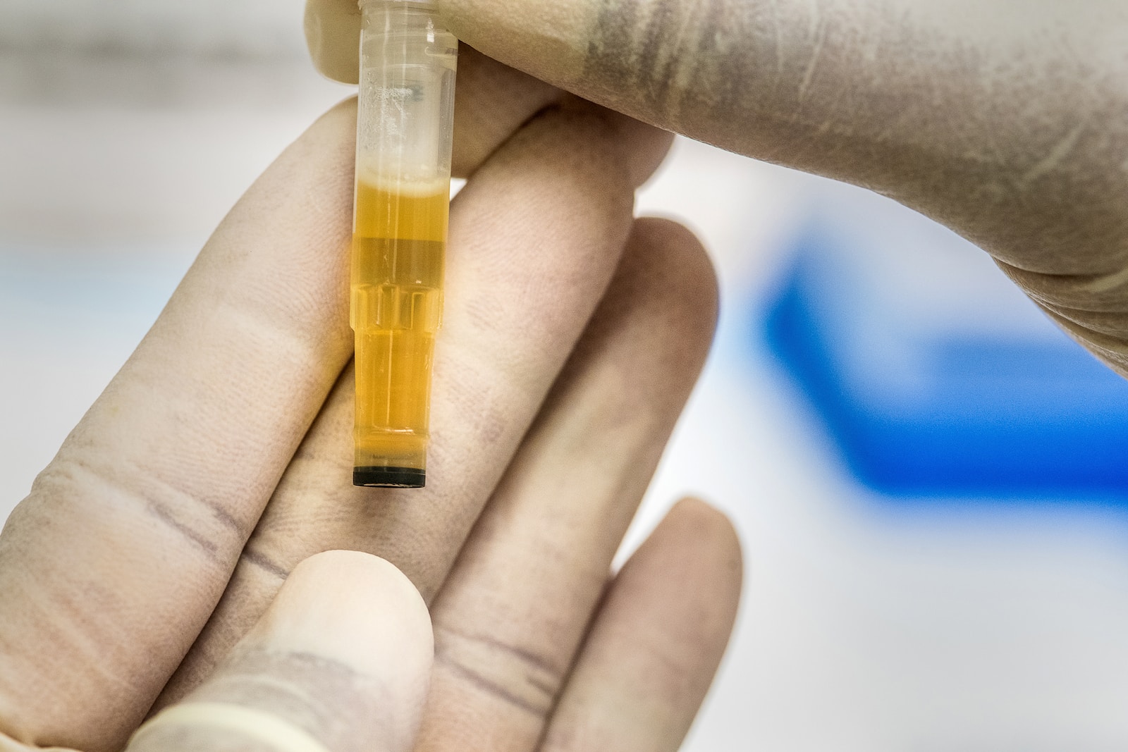 How Long Does THC Stay In Urine (And Why)? Exactly How Long